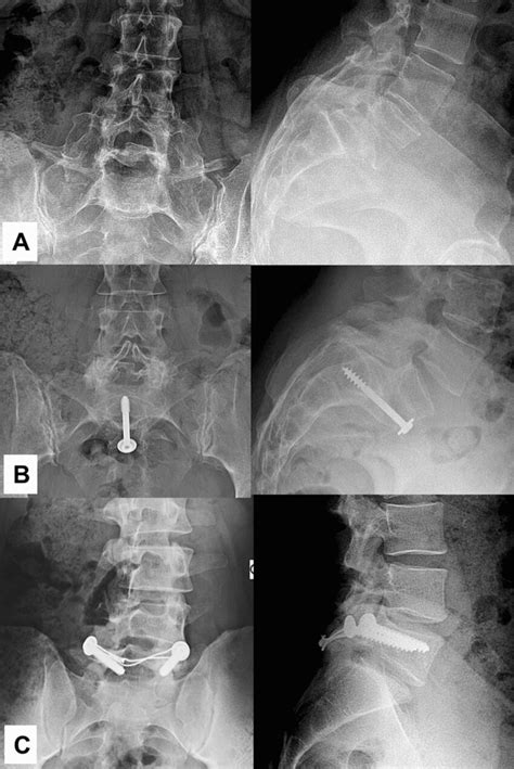 Examples Of Surgical Techniques Performed A Non Instrumented