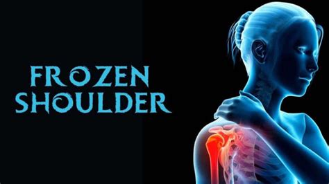 Mengenal Posisi Tidur Yang Baik Bagi Penderita Frozen Shoulder Fisiohome