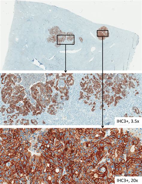 Her 3 Immunohistochemical Staining Of Tissue Samples From Liver Download Scientific Diagram