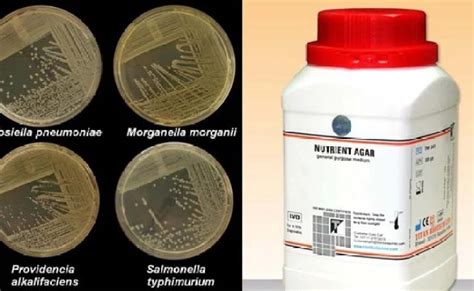 Nutrient Agar Principle Composition Preparation And Uses Otosection