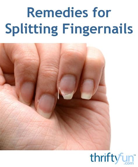 Remedies For Splitting Fingernails Peeling Nails Splitting