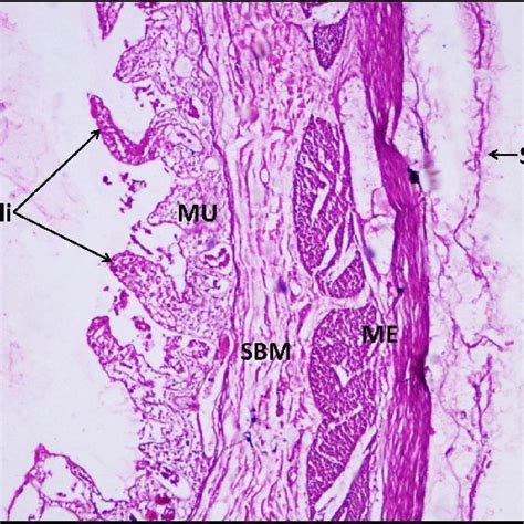 Photomicrograph Of The Section Of Meckels Diverticulum Stained With