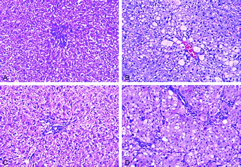 Liver Tissue Of The Rats In The Control And Hepatic Fibrosis Groups