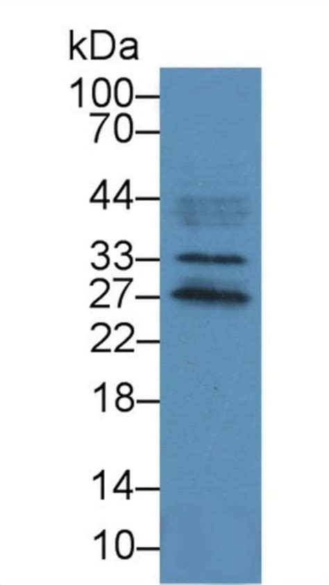 Dcl Polyclonal Antibody Invitrogen L Unconjugated Fisher