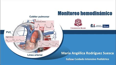 Monitoreo Hemodinamico I Parte De Curso Fisiolog A Ucip