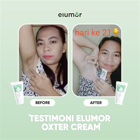 Elumor Oxter Cream New Formula 30 Gr Groin Whitening And Miss V Underarm Whitening Neck