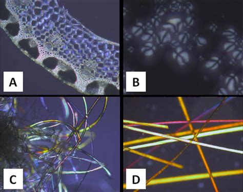 Some Biological Samples Observed In Polarizing Light Microscope