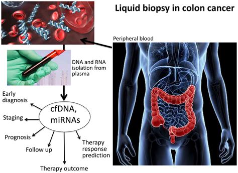 Liquid Biopsy And Pcr Free Ultrasensitive Detection Systems In Oncology