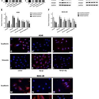 Knock down of HMGB1 reversed the TGF β1 induced EMT in airway