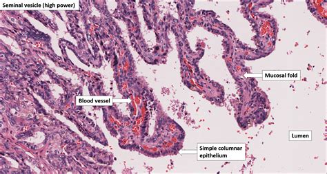 Seminal vesicle – Normal Histology – NUS Pathweb :: NUS Pathweb