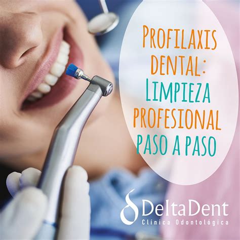 Profilaxis Dental Limpieza Profesional Paso A Paso Clinica Dental