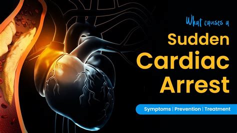 What Causes A Sudden Cardiac Arrest Symptoms Prevention Tips And