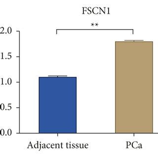 FSCN1 Activates The YAP TAZ Signaling Pathway In Prostate Cancer Cells