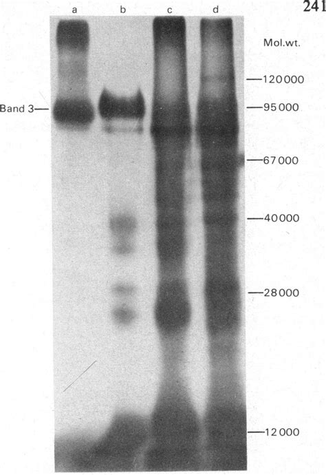 Autoradiograph Of An Sds Polyacrylamide Gel Electrophoretic Separation