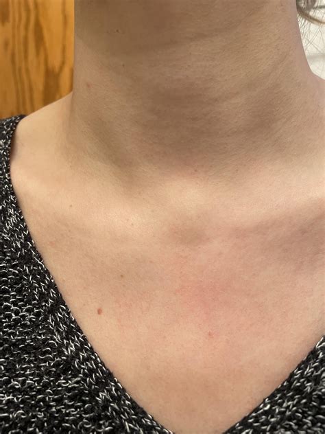 Whats Up With This Hard Lump In Between My Collar Bones Should I Be