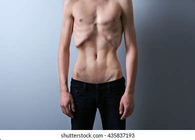 508 Anorexic Man Images, Stock Photos, 3D objects, & Vectors | Shutterstock