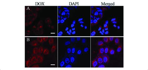 Clsm Images Of Hela Cells After Treatment With Dox Loaded Magnetic