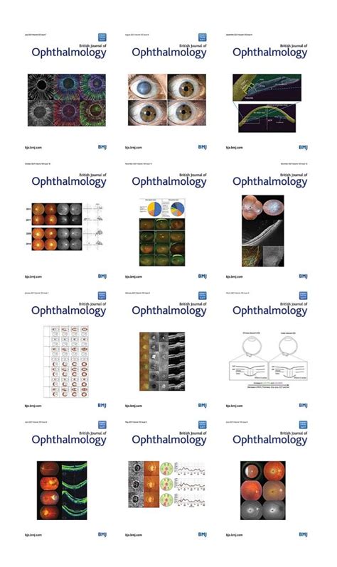 British Journal Of Ophthalmology 2021 Full Archives True Pdf Medical Books And Cme Courses