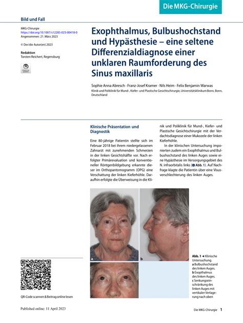 (PDF) Exophthalmus, Bulbushochstand und Hypästhesie – eine seltene Differenzialdiagnose einer ...