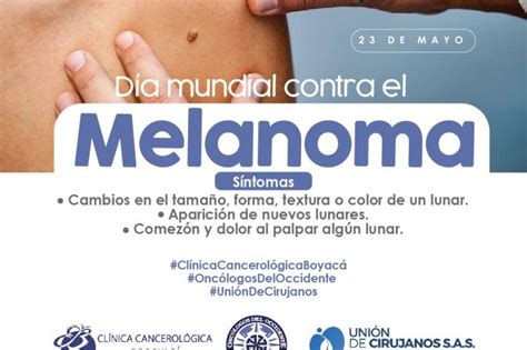 23 De Mayo Día Mundial Contra El Melanoma • Oncólogos Del Occidente S