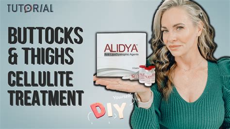 Unlock The Secret To Diy Cellulite Treatment At Home Alidya