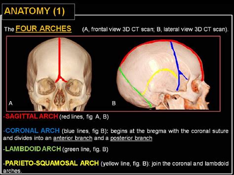 Figure 7 from Radiological assessment of skull sutures in Patients with ...