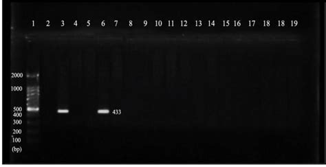 An Ethidium Bromide Stained Gel Demonstrating The Typical Banding