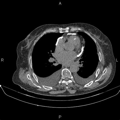 Image Radiopaedia Org