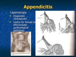 Appendix, Surgery