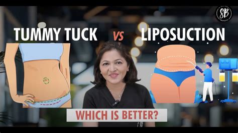 Tummy Tuck Vs Liposuction Which Is Better Tummy Tuck Surgery Vs Liposuction Sb Aesthetics