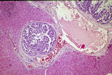 Hepatic Coccidiosis Rabbit