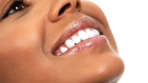 Teeth Whitening Philadelphia Brighter Smile Dentex Dental Group