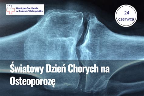 Światowy Dzień Chorych na Osteoporozę Stowarzyszenie Hospicjum św Kamila