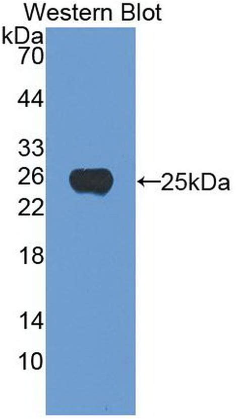 Noggin Monoclonal Antibody A7 Ma5 41653