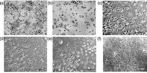 Endometrium Epithelial Cell Culture A Isolated Endometrium Cell