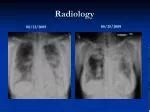 Ppt Introduction To Thoracic Radiology Powerpoint Presentation Free