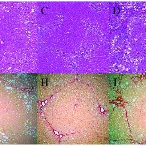 Typical Hematoxylin And Eosin Hande Staining And Picrosirius Red