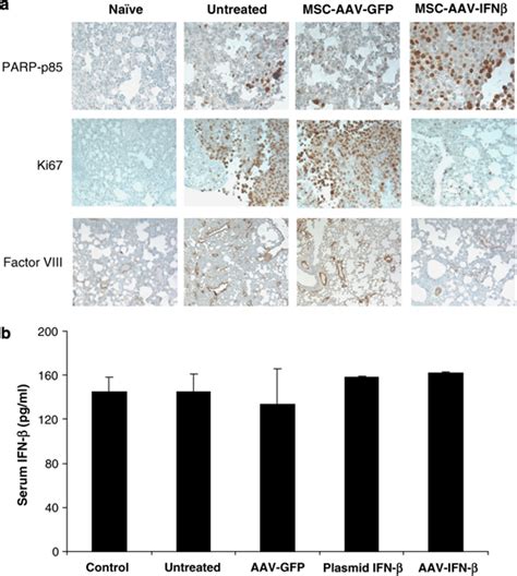 Immunochemistry Of Lungs With Tramp C Cells For Apoptosis Cell