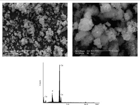 Figure 3 From Synthesis Of Nanocrystalline Hydroxyapatite Using