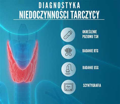 Niedoczynno Tarczycy Objawy I Rozpoznanie Choroby Polki Pl