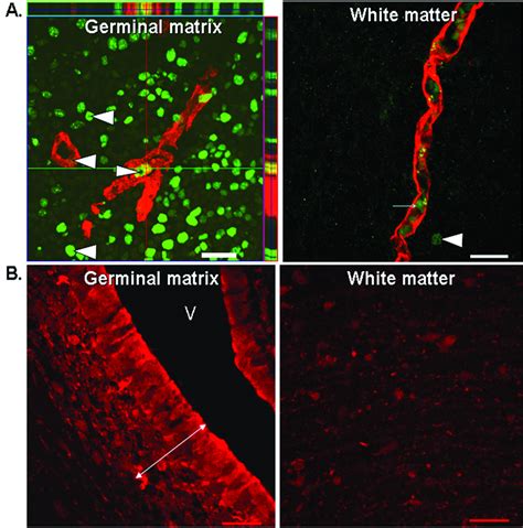 Germinal Matrix Anatomy