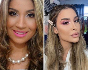 Boca Rosa Antes E Depois