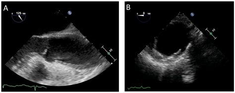 Diagnostics Free Full Text The Role Of Multimodality Imaging