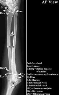 Radiographic positioning: Forearm - AP