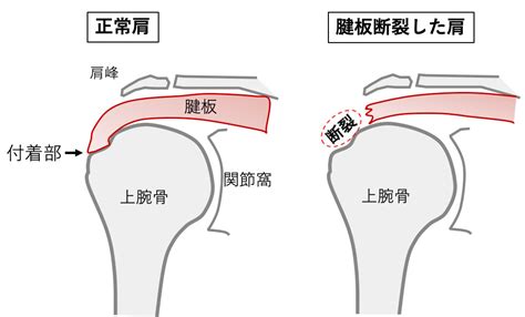 投球時の肩の痛み‐野球肩の症状と原因、予防法 田中スポーツ整骨院