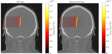 PET Experimental Medical Physics LMU Munich