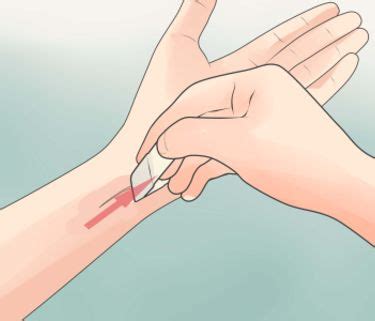 Treating Cuts How To Articles From Wikihow