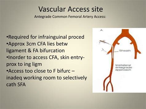 Ppt Peripheral Angioplasty Overview Hardware Powerpoint Presentation