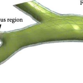 Pulmonary artery stenosis model. | Download Scientific Diagram