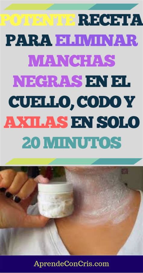 Potente Receta Para Eliminar Manchas Negras En El Cuello Codo Y Axilas Sexiz Pix